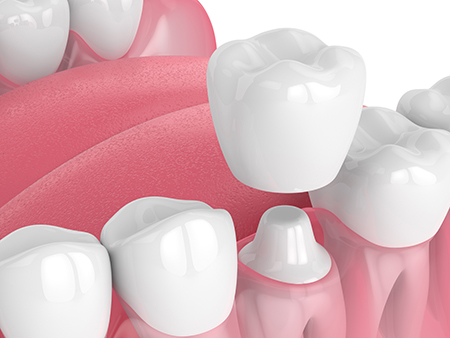 Dentistry of Sugar Land | Periodontal Treatment, Digital Impressions and CBCT