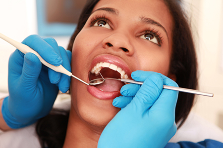 Woman getting her teeth cleaned by dental professional, with focus on her mouth and the cleaning process.